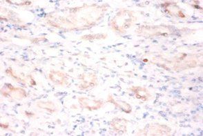BTBD2 Antibody