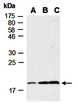 BTC antibody