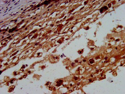 BTD Antibody