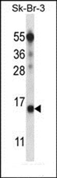 BTF3L4 antibody