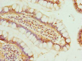 BTG1 antibody