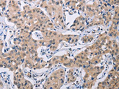 BTG1 Antibody