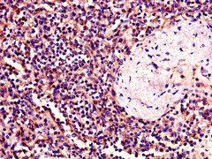 BTK Antibody