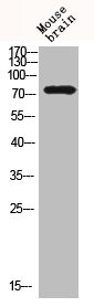 BTK Antibody