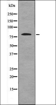BTK (Phospho-Ser179) antibody