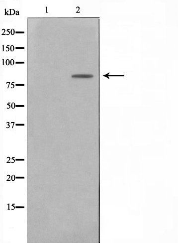 BTK (Phospho-Tyr223) antibody