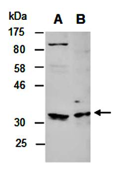 BTLA antibody