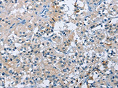BTN2A2 Antibody