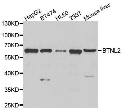 BTNL2 antibody