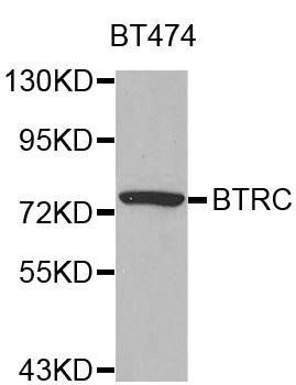 BTRC antibody
