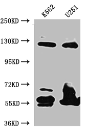BUB1B Recombinant Monoclonal Antibody