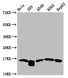 Butyrly-HIST1H3A (K122) antibody