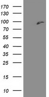 Butyrylcholinesterase (BCHE) antibody