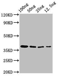 BZLF2 antibody