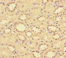 C-C motif chemokine 14 antibody