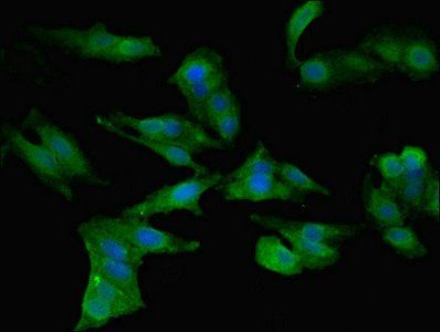 CCL2 Antibody