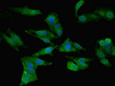 C-C motif chemokine 2 antibody