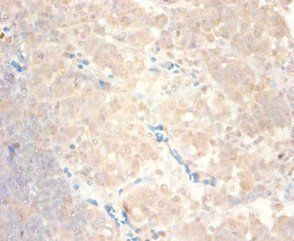 CCL24 Antibody