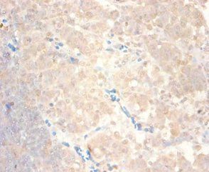 C-C motif chemokine 24 antibody