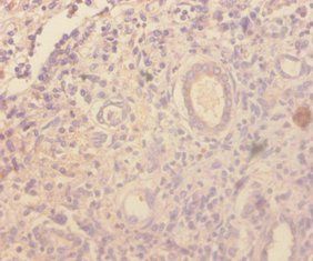 Ccl4 Antibody