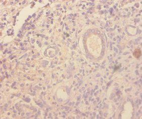 C-C motif chemokine 4 antibody