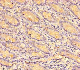 CCL8 Antibody