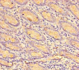 C-C motif chemokine 8 antibody