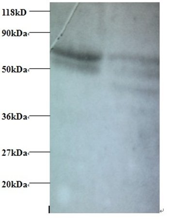 C-C motif chemokine 5 antibody (Biotin)