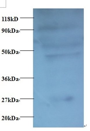 C-C motif chemokine 7 antibody (Biotin)