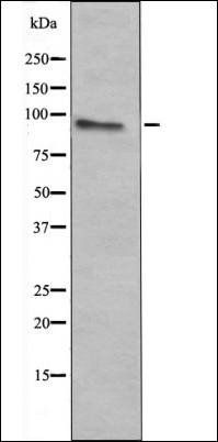 c-Fes (Phospho-Tyr713) antibody