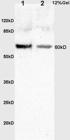 c-FOS(phospho-Thr232) antibody