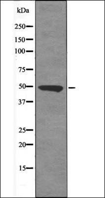 c-Jun (Phospho-Ser249) antibody