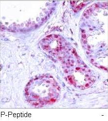 c-Jun (Phospho-Ser243) Antibody