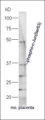 c-Jun(phospho-Ser63) antibody