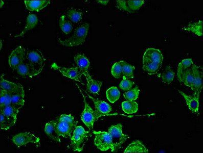 KIT Antibody