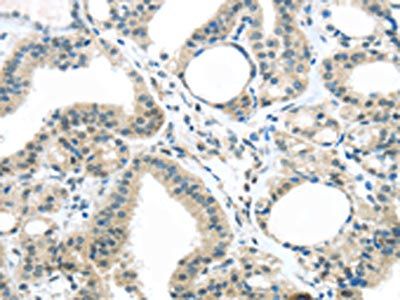 KIT Antibody