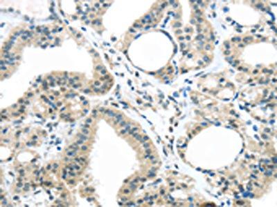 c-Kit antibody