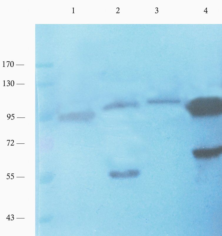 c-Kit Rabbit Polyclonal Antibody
