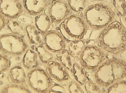 c-myc antibody