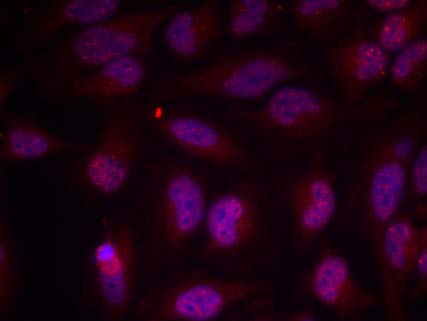 Myc (Phospho-Thr358) Antibody