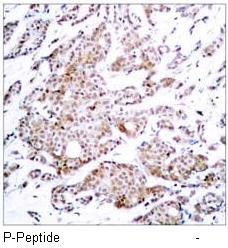 Myc (Phospho-Thr58) Antibody