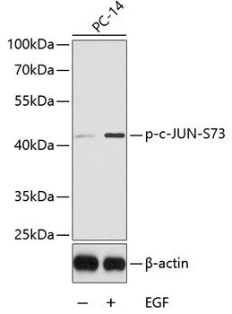 c (Phospho-JUN (Phospho-S73) antibody