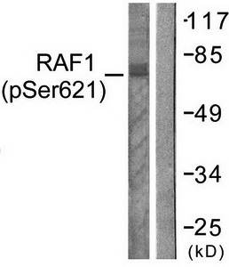 C-RAF (phospho-Ser621) antibody