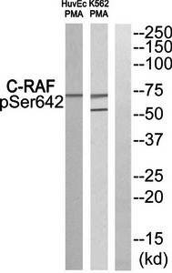 C-RAF (phospho-Ser642) antibody