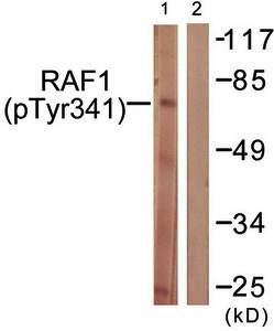 C-RAF (phospho-Tyr341) antibody