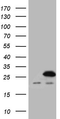 C Reactive Protein (CRP) antibody