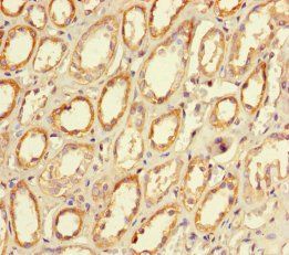 C-type lectin domain family 18 member A antibody