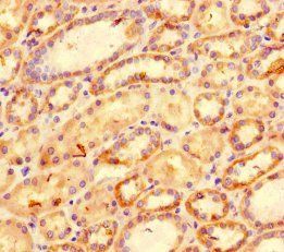 C-X-C motif chemokine 11 antibody