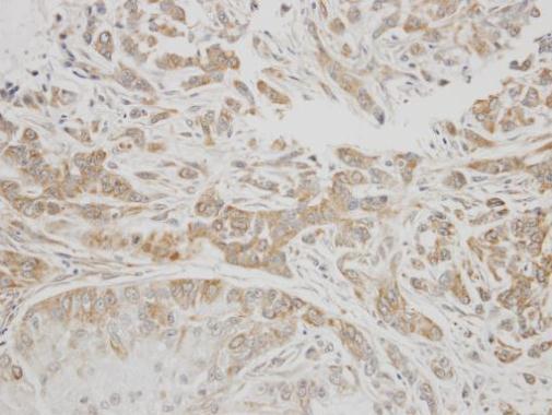 C1 inhibitor Rabbit Polyclonal Antibody