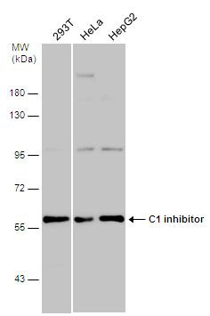 C1 inhibitor Rabbit Polyclonal Antibody